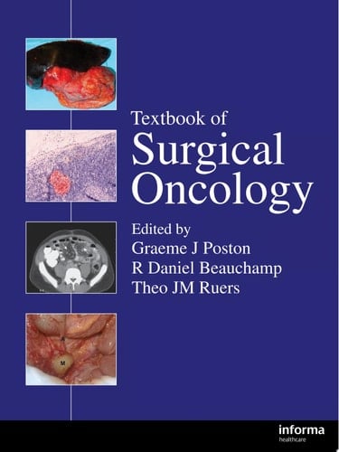 Textbook of Surgical Oncology
