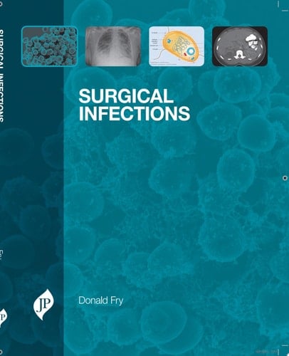 Surgical Infections