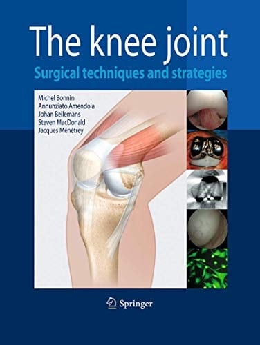 The Knee Joint Surgical Techniques and Strategies