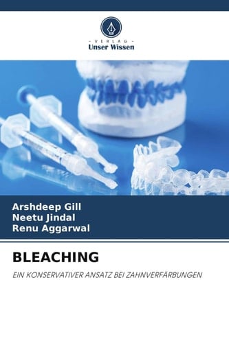 BLEACHING: EIN KONSERVATIVER ANSATZ BEI ZAHNVERFÄRBUNGEN (German Edition)