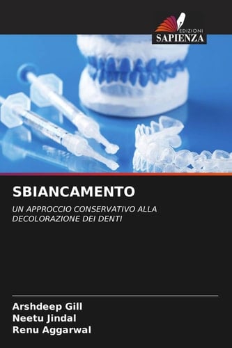 SBIANCAMENTO: UN APPROCCIO CONSERVATIVO ALLA DECOLORAZIONE DEI DENTI (Italian Edition)