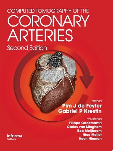 Computed Tomography of the Coronary Arteries