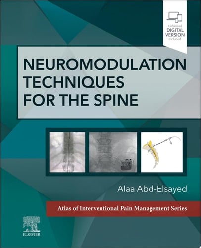 Neuromodulation Techniques for the Spine - E-Book A Volume in the Atlas of Interventional Pain Management Series