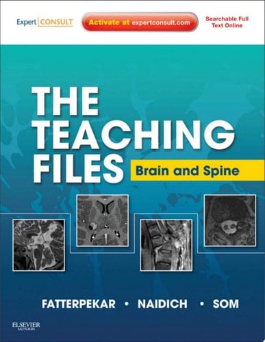 The Teaching Files: Brain and Spine Imaging E-Book