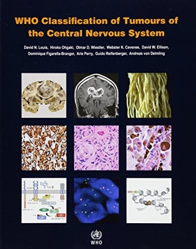 Who Classification of Tumours of the Central Nervous System