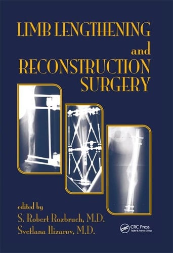 Limb Lengthening and Reconstruction Surgery