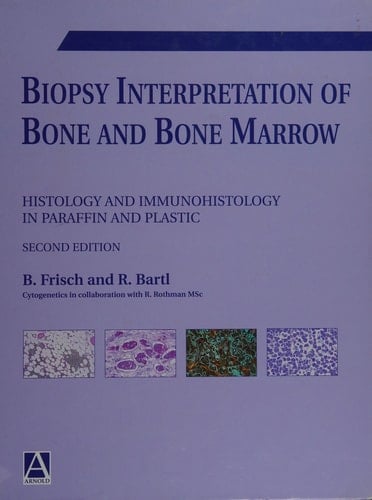 Biopsy Interpretation of Bone and Bone Marrow, 2Ed
