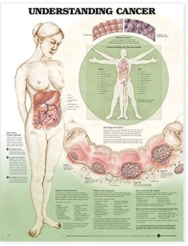 Understanding Cancer Anatomical Chart