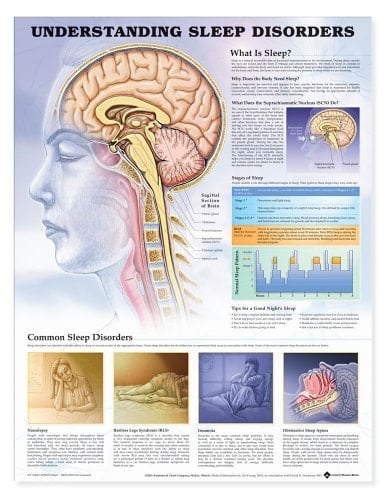 Understanding Sleep Disorders Anatomical Chart