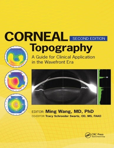 Corneal Topography A Guide for Clinical Application in Wavefront Era