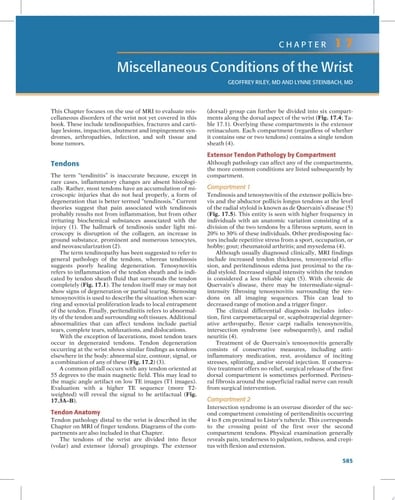 MRI of the Upper Extremity Shoulder, Elbow, Wrist and Hand