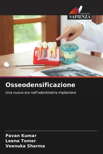 Osseodensificazione: Una nuova era nell'odontoiatria implantare (Italian Edition)