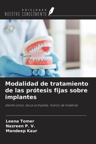 Modalidad de tratamiento de las prótesis fijas sobre implantes: diente único, boca completa, marco de material (Spanish Edition)