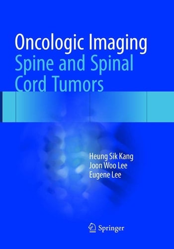 Oncologic Imaging: Spine and Spinal Cord Tumors