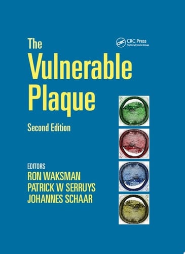 Handbook of the Vulnerable Plaque