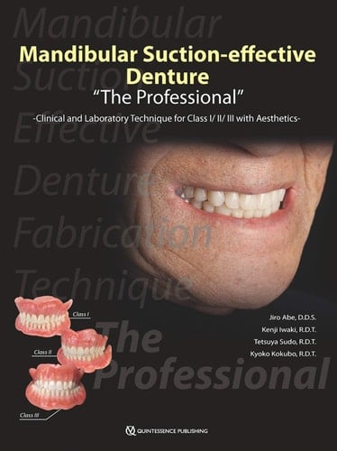 Mandibular Suction-effective Denture "the Professional" Clinical and Laboratory Technique for Class I/II/III with Aesthetics