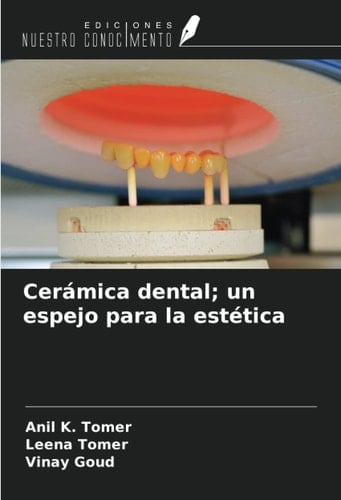 Cerámica dental; un espejo para la estética (Spanish Edition)