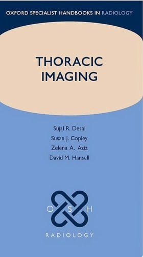 Thoracic Imaging (Oxford Specialist Handbooks in Radiology)