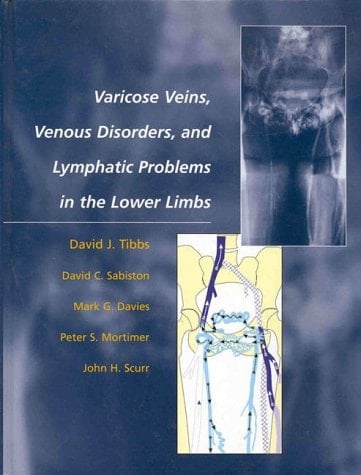 Varicose Veins, Venous Disorders, and Lymphatic Problems in the Lower Limbs