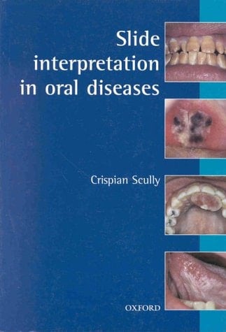 Slide Interpretation in Oral Diseases (Oxford Medical Publications)