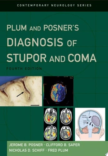 Plum And Posner's Diagnosis Of Stupor And Coma
