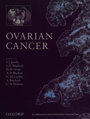 Ovarian Cancer: State of the Art and New Developments