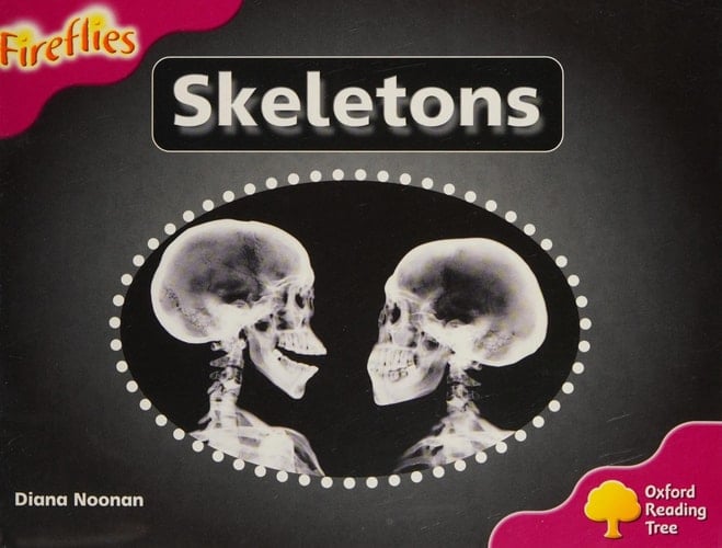 Oxford Reading Tree: Stage 10: Fireflies: Pack (6 Books, 1 of Each Title)