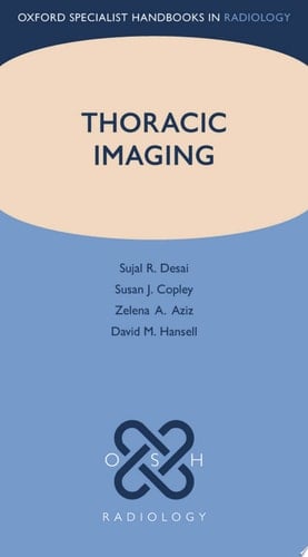 Thoracic Imaging (Oxford Specialist Handbooks in Radiology)