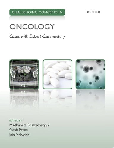 Challenging Concepts in Oncology: Cases with Expert Commentary (Challenging Cases)
