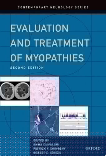 Evaluation And Treatment Of Myopathies