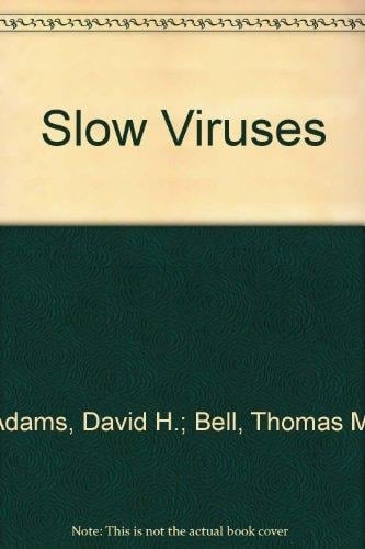 Slow Viruses