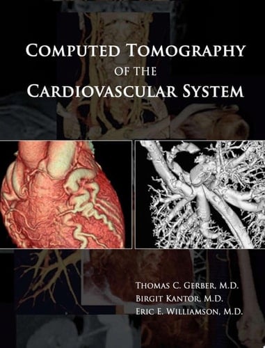 Computed Tomography of the Cardiovascular System