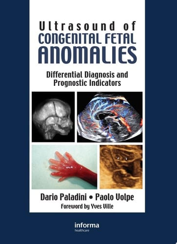 Ultrasound of Congenital Fetal Anomalies