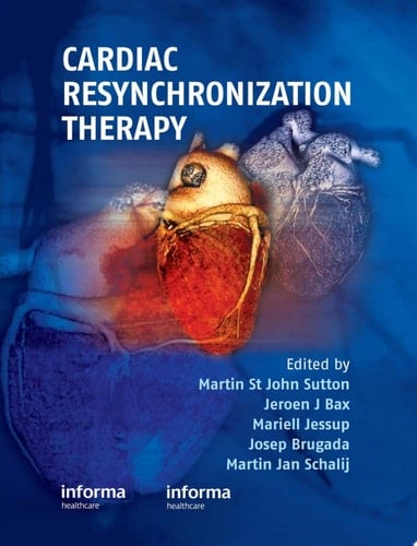Cardiac Resynchronization Therapy
