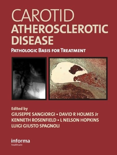 Carotid Atherosclerotic Disease: Pathologic Basis for Treatment