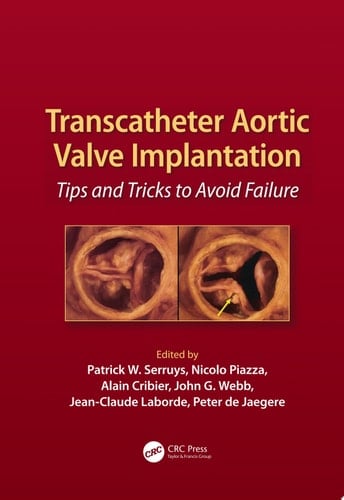 Transcatheter Aortic Valve Implantation: Tips and Tricks to Avoid Failure