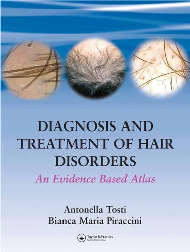 Diagnosis and Treatment of Hair Disorders: An Evidence-Based Atlas