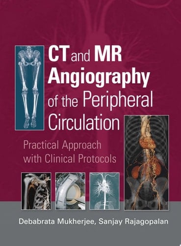 CT and MR Angiography of the Peripheral Circulation: Practical Approach with Clinical Protocols