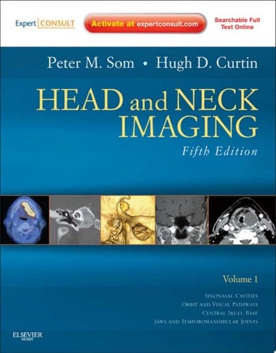 Head and Neck Imaging E-Book Head and Neck Imaging E-Book