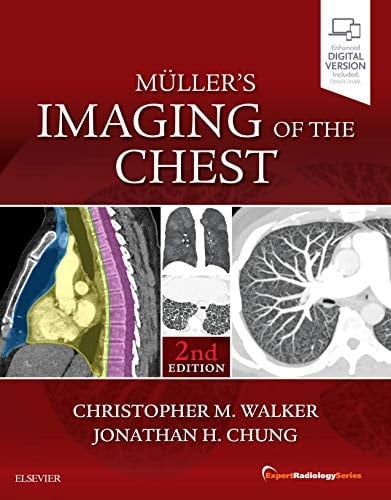 Muller's Imaging of the Chest Expert Radiology Series