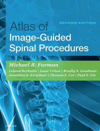 Atlas of Image-Guided Spinal Procedures E-Book Atlas of Image-Guided Spinal Procedures E-Book