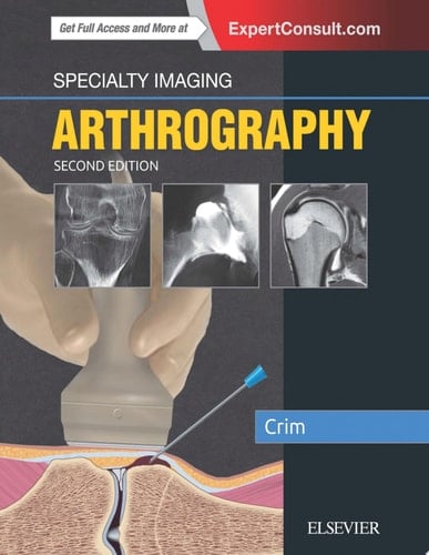 Specialty Imaging: Arthrography E-Book Specialty Imaging: Arthrography E-Book