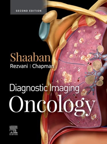 Diagnostic Imaging: Oncology