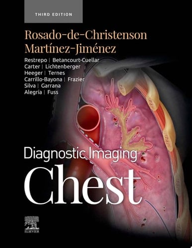 Diagnostic Imaging: Chest