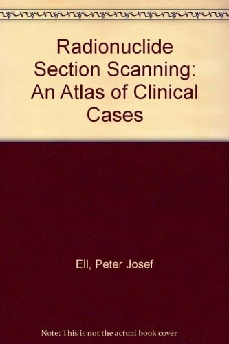 Radionuclide Section Scanning An Atlas of Clinical Practice