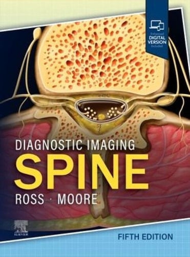 Diagnostic Imaging: Spine