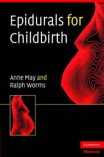 Epidurals for childbirth: a guide for all delivery-suite staff