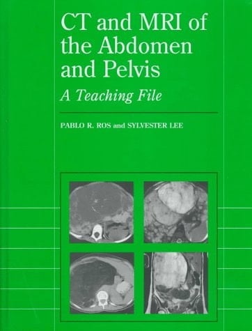CT and MRI of the Abdomen and Pelvis: A Teaching File (Radiology Teaching File)