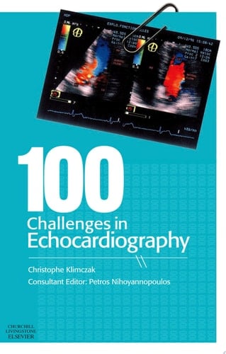 100 Challenges in Echocardiography E-Book