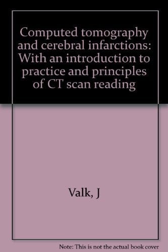 Computed Tomography and Cerebral Infarctions With an Introduction to Practice and Principles of CT Scan Reading